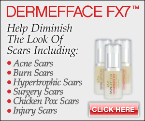Dermefface FX7 Scar Reduction Therapy Cream Review