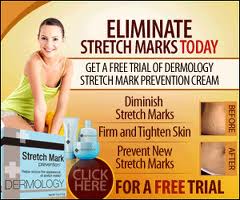 Dermology Stretch Marks Removal Cream Review