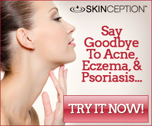 Skinception Argan Oil Psoriasis and Eczema Treatments Product
