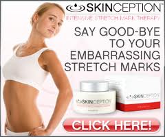 Skinception Stretchmarks Therapy Cream Review