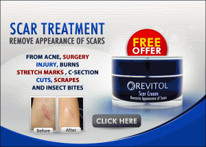 revitol scar cream review