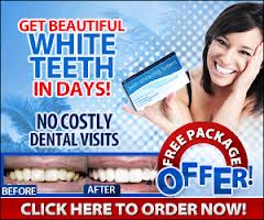 Bella Teeth Whitening Kits Review