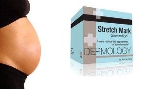 dermology stretchmark cream review