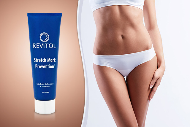Natural Stretchmark Treatment Creams Review - Revitol